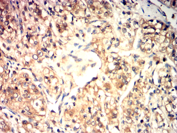 TRIM21 Antibody