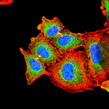 TFF3 Antibody