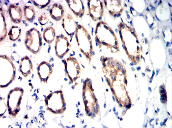 TFF3 Antibody