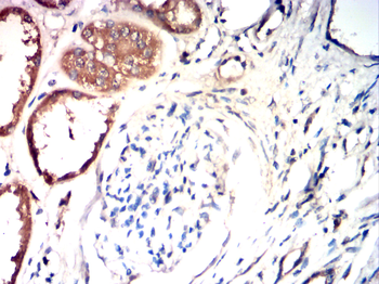 TFF3 Antibody