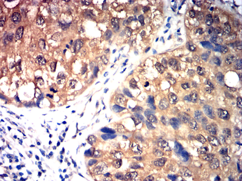TFF3 Antibody