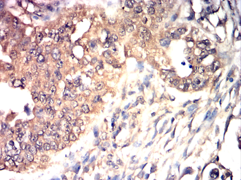 TFF3 Antibody