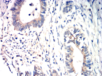 TFF3 Antibody