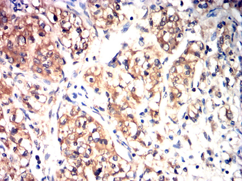 TFF3 Antibody