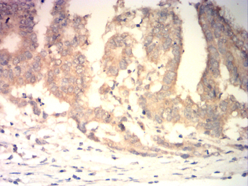 EIF5A Antibody