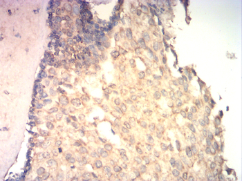 EIF5A Antibody