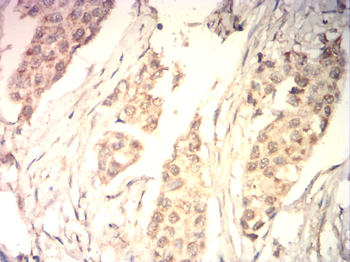 EIF5A Antibody