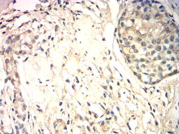 EIF5A Antibody