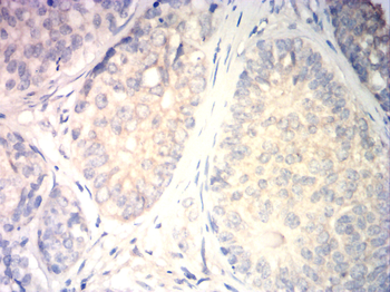 EIF5A Antibody