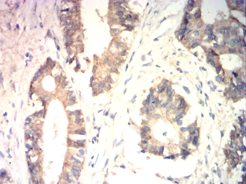 CTNNB1 Antibody