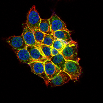 CTNNB1 Antibody