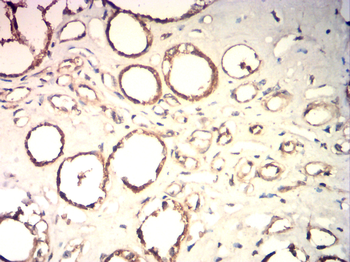 CTNNB1 Antibody