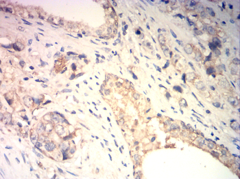 CTNNB1 Antibody