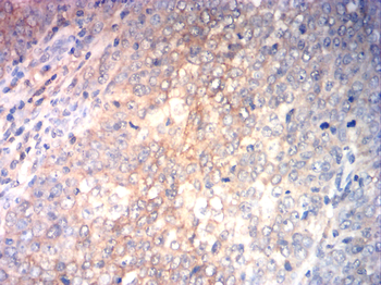 JUP Antibody