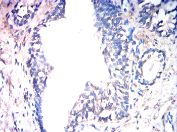 JUP Antibody