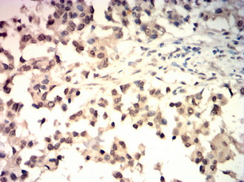 E2F1 Antibody