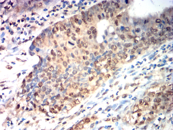 E2F1 Antibody
