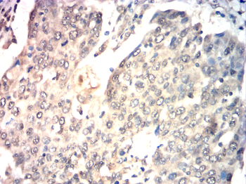 E2F1 Antibody