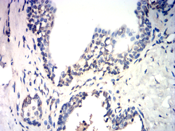 E2F1 Antibody