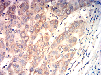 VEGFB Antibody