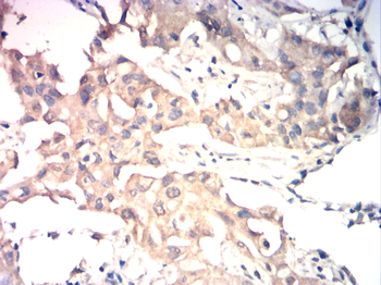 VEGFB Antibody