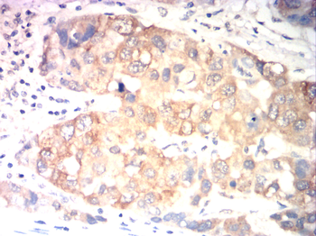 CYP2E1 Antibody