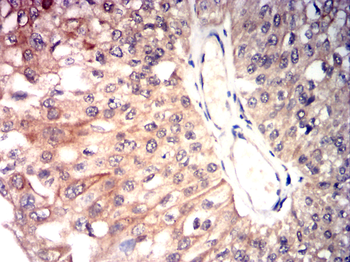 NOX4 Antibody