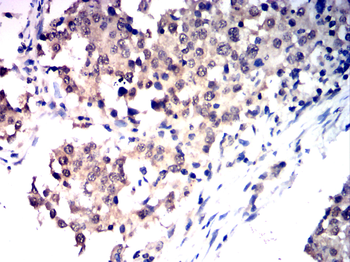 NOX4 Antibody