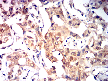 NOX4 Antibody