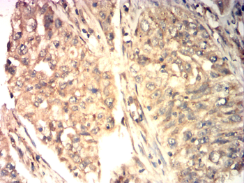 PLK1 Antibody