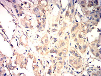 PLK1 Antibody