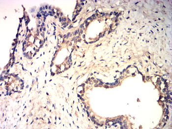 PLK1 Antibody