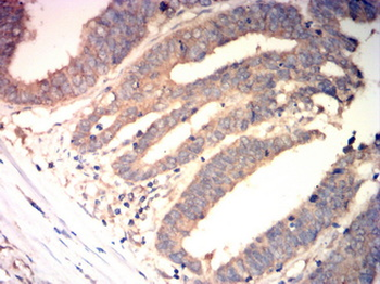 PLK1 Antibody