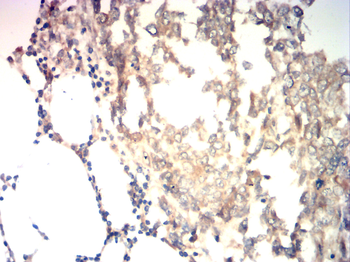 FST Antibody