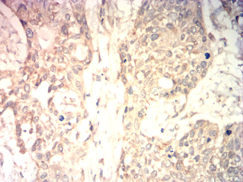FST Antibody