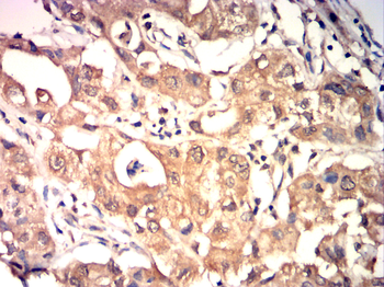 FST Antibody