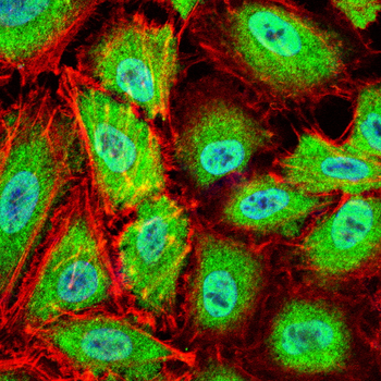 TERT Antibody