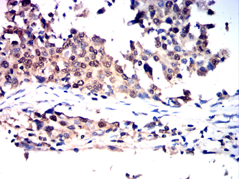 TERT Antibody