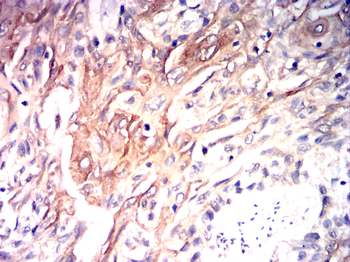 TERT Antibody