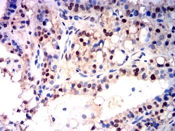 TERT Antibody