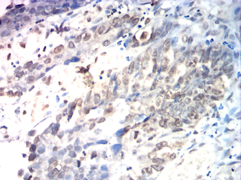 RIPK3 Antibody