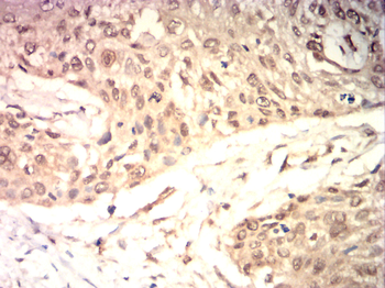 RIPK3 Antibody