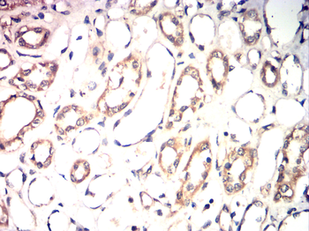 RIPK3 Antibody