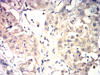 RIPK3 Antibody