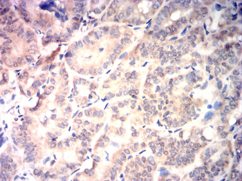 RIPK3 Antibody
