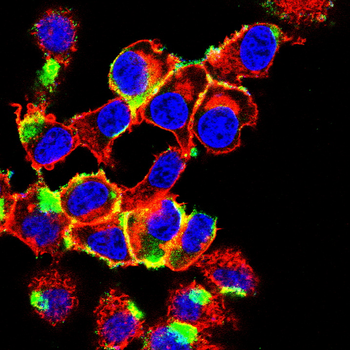 TRPM2 Antibody