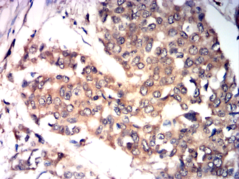 TRPM2 Antibody