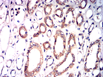 TRPM2 Antibody