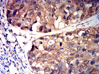 TRPM2 Antibody