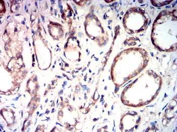TRPM2 Antibody